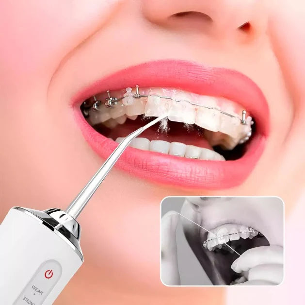 IRRIGADOR ORAL WINNER