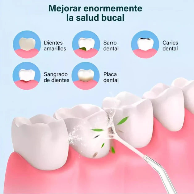 IRRIGADOR ORAL WINNER